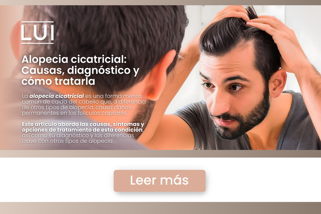 Alopecia cicatricial: Causas, diagnóstico y cómo tratarla
