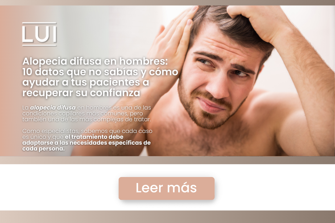 Alopecia difusa en hombres: 10 datos que no sabías y cómo ayudar a tus pacientes a recuperar su confianza