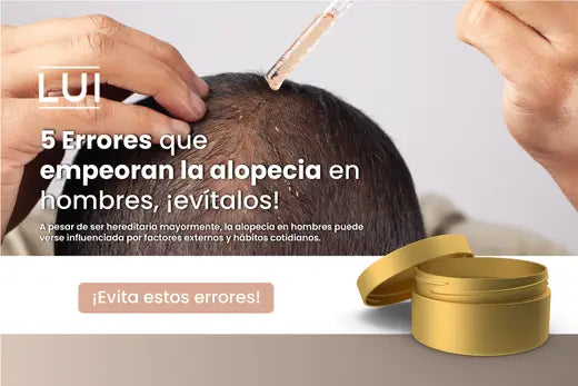 5 Errores que empeoran la alopecia en hombres ¡evítalos!