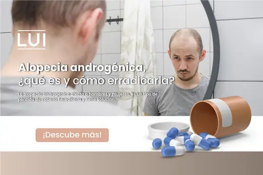 Alopecia androgénica ¿qué es y cómo erradicarla?
