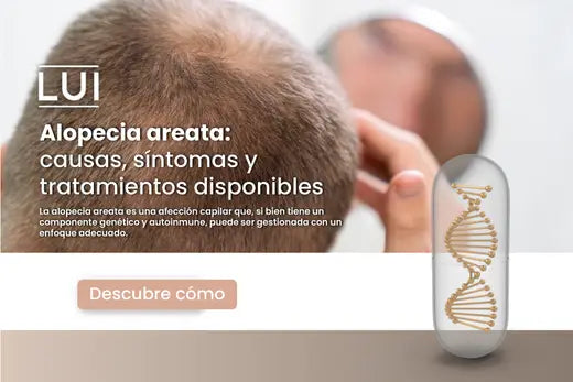Alopecia areata: causas síntomas y tratamientos disponibles