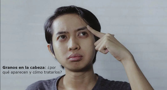 Granos en la cabeza: ¿por qué aparecen y cómo tratarlos?