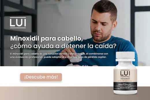 Minoxidil para cabello ¿cómo ayuda a detener la caída?