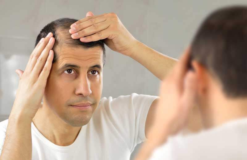 Principales causas detrás de la pérdida de cabello